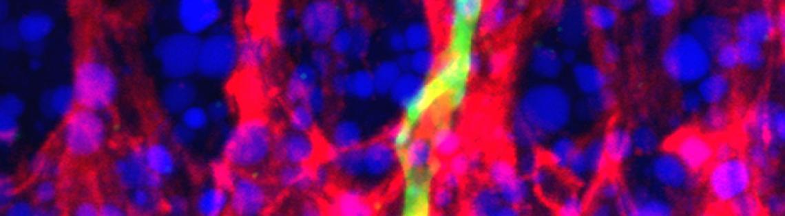 Red rods with bursts of hot pink, wisps of green and blue dots