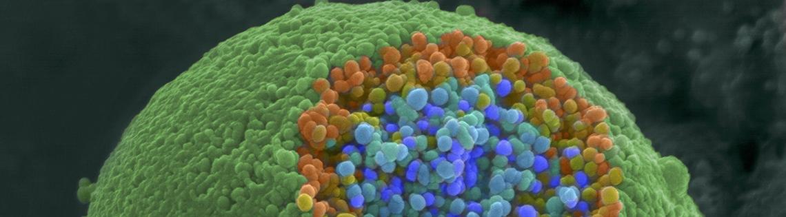 Scientific image of green globe-like object with small blue and orange bubbles spilling from the top.