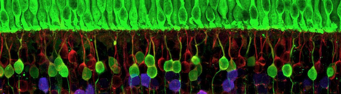 Scientific image of bright green cells on top of reddish purple cells