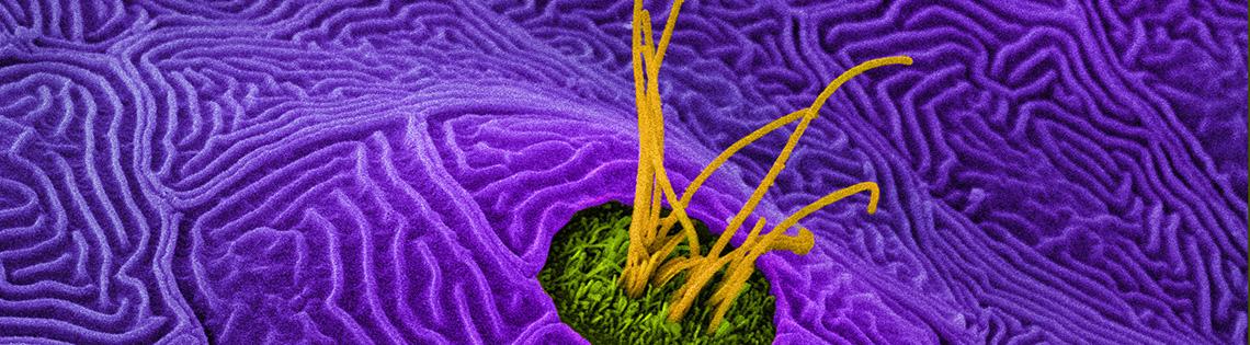 Large purple swirls surround green circle with protruding yellow strips