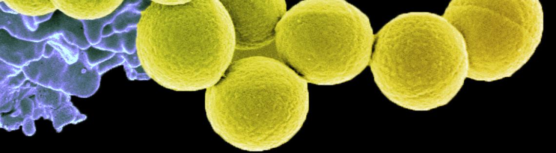 Cells that look like tennis balls