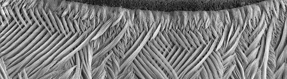 Enamel rods protecting a tooth’s surface