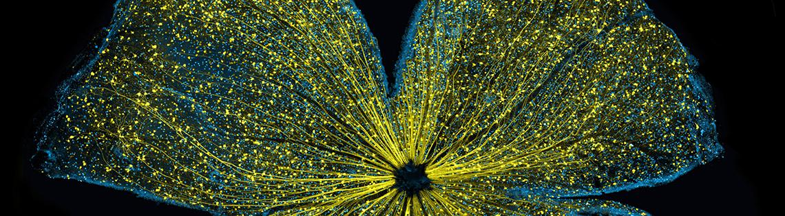 A mouse retina appears as a large, 4-petaled flower of gold glitter against a black backdrop