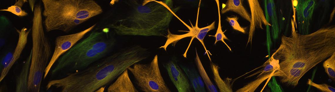 Scientific image of gold starbursts with purple spots on background of dark green and black