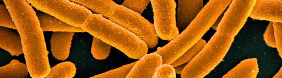 E-coli bacteria appear as wide, yellow rods against black background