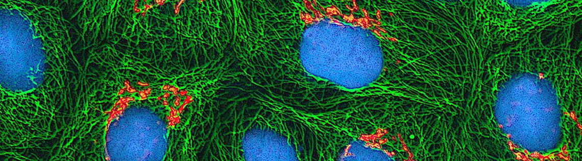 Scientific image of blue egg-shapes nestled in green grass-like substance