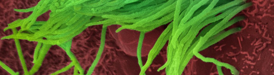 scientific image of green spaghetti-like strands on bed of red