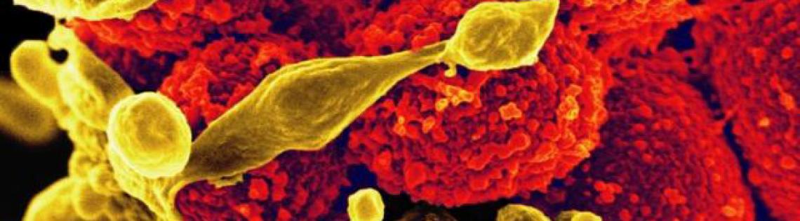 Scientific image of red globes bunched together with yellow ribbon-like substance threading through them