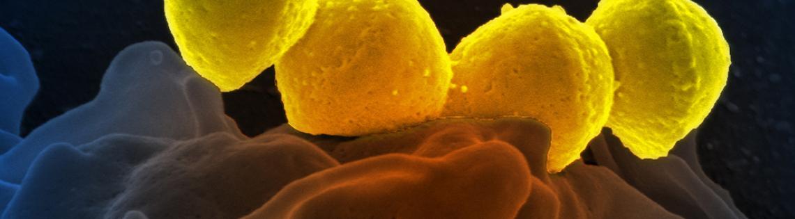 Streptococcus pyrogenese bound to a human neutrophil 