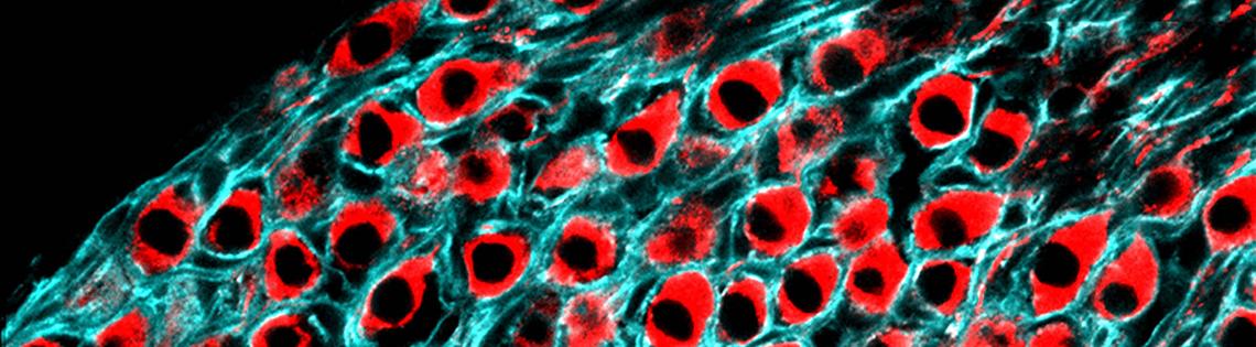 Section of auditory nerve in a young adult mouse