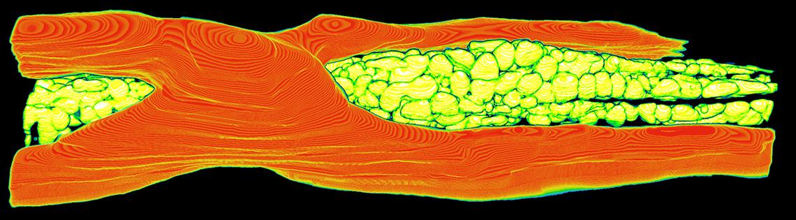 Blood vessel and mitochondria in a mouse heart viewed under microscope
