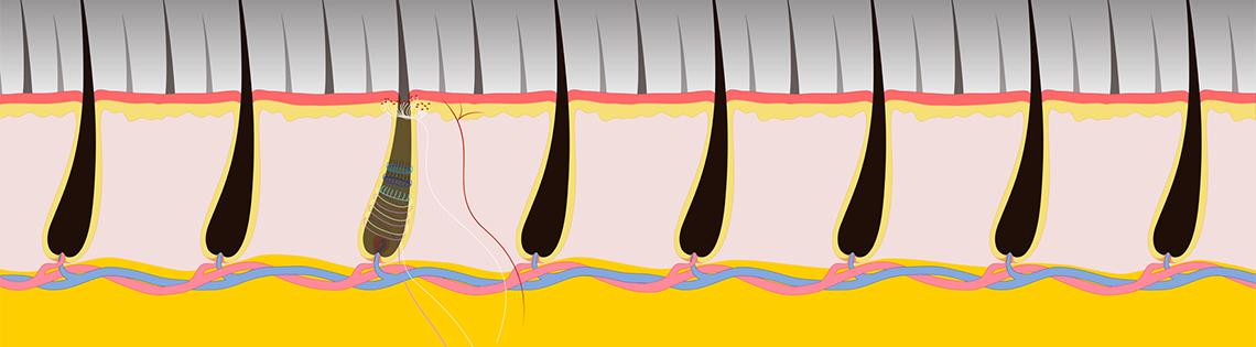 Neuron responds to pulling of single hair.