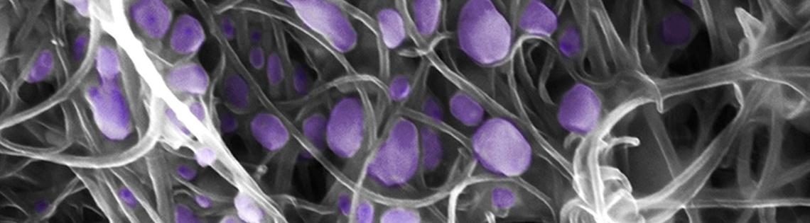 H5N2 avian influenza virus trapped in carbon nanotubes.