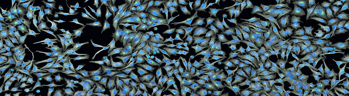 Panoramic view of HeLa cells.