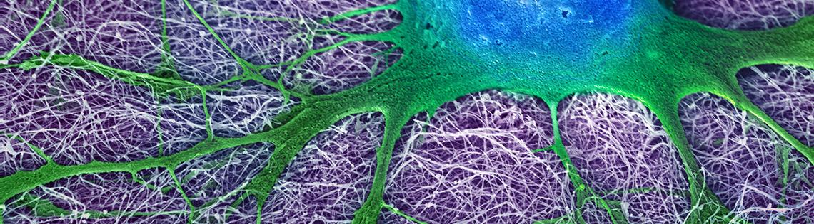 Scientific image of substance stretched over woven fiber-like structure