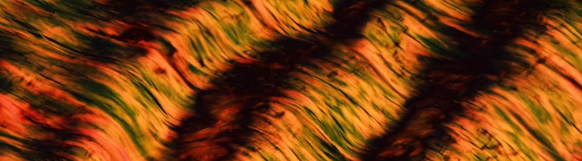 Brown and beige wavy lines of collagen fibers in the knee