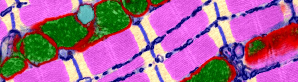Electron microscopic image of single heart cell in an adult mouse
