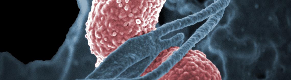 Grayish-colored strands of neutrophil wrap around klebsiella bacterium, shown in pink.