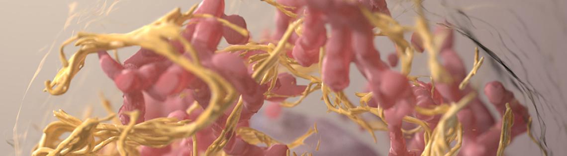 Large pink dots with yellow strands make up the 3-D structure of a melanoma cell