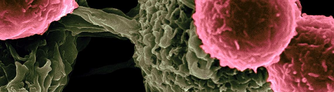 Scanning electron microscopic cells shaped like popcorn, colored green and pink