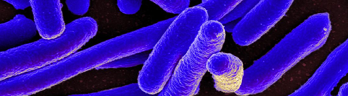 Several purple, cylinder-shaped  E. coli bacteria