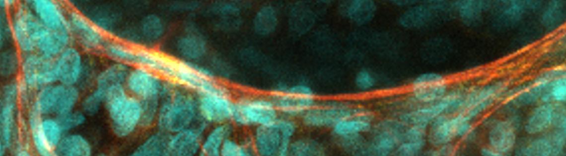 Scientific image of red ribbons threaded through oblong green spots