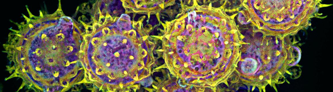 Yellow, purple and red pollen grains have spikes on their surface