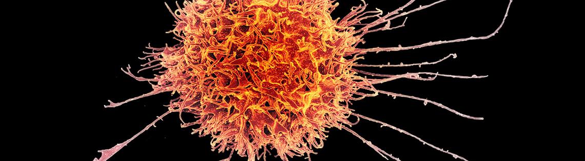 Human Natural Killer Cell