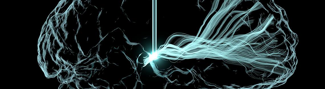 Light me up brain image