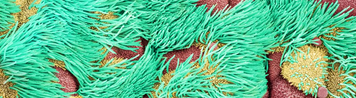 Cilia, looking like clumps of green grass, surround reddish and yellow masses in a mouse's trachea