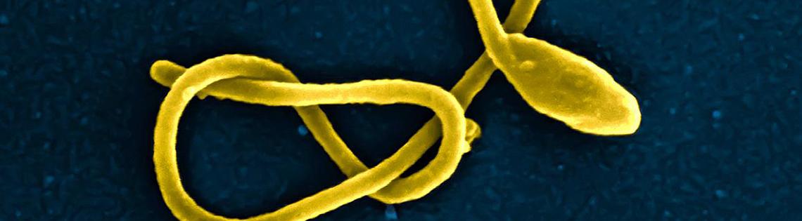 Ebola virus particle