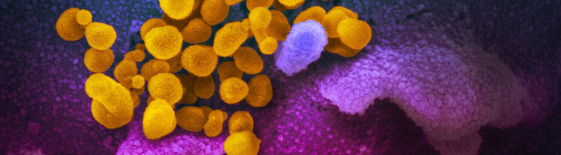 Scientific image featuring small yellow globes bubbling up from purplish pink ribbon