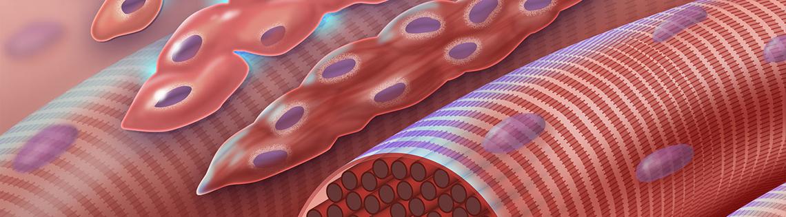 This graphic depicts normal myoblast (early muscle cells with a single nucleus) fusing together to form myocytes (multinucleated muscle cells) during myogenesis.