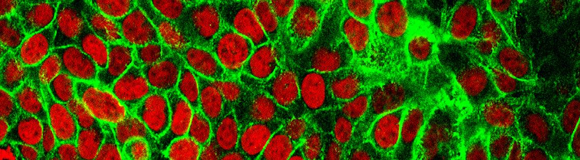 scientific image of red oblong orbs swimming amid glowing green background