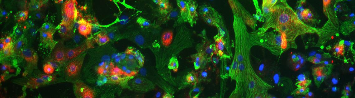 Wisps of green and blue (heart cells) speckled with multicolored dots representing covid