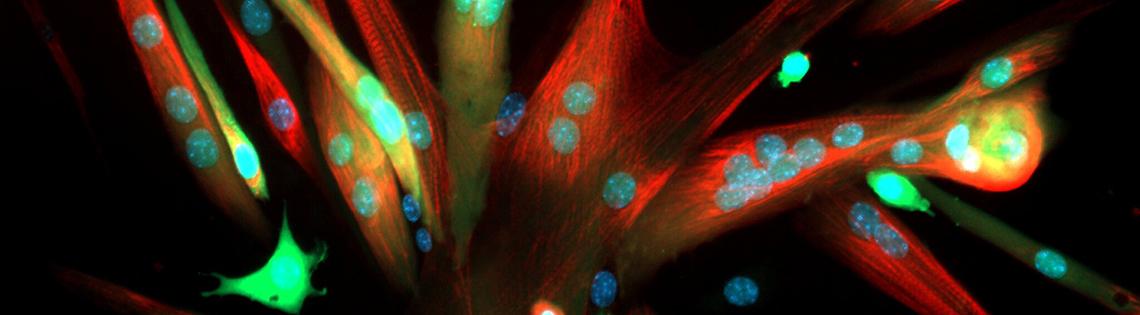 Cells from mouse skeletal muscle stem cells glow green.