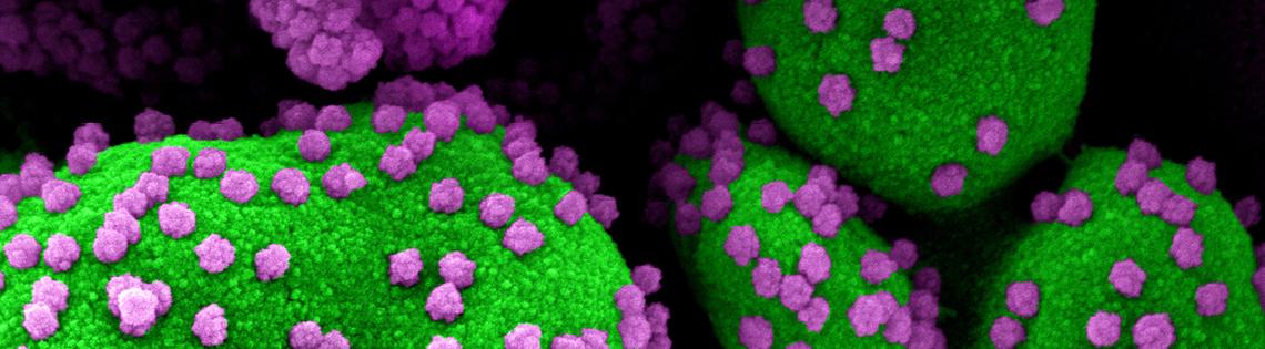 Big fuzzy green circles are covered in small purple particles.