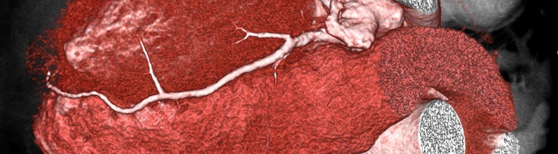 A medical image of a heart muscle