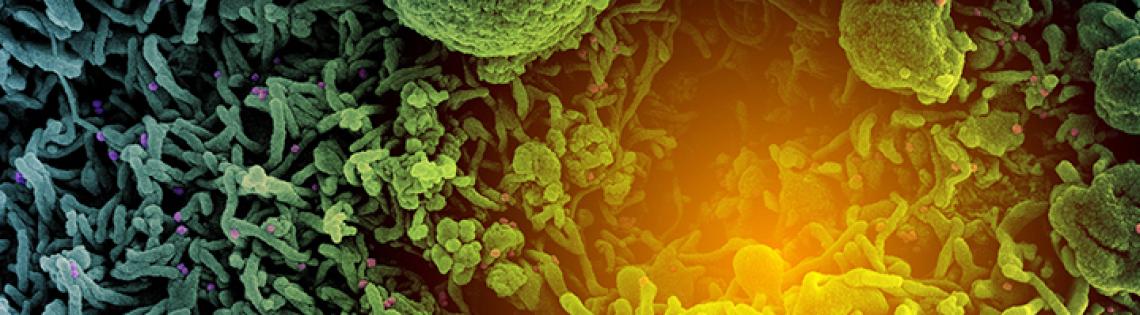 A microscopic view of variant strain of SARS-CoV-2 virus particles