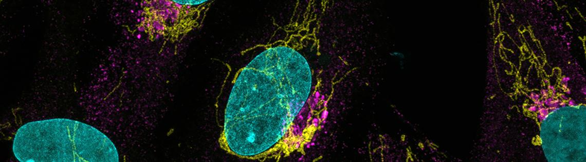 A microscopic image revels La Crosse virus in neural stem cells