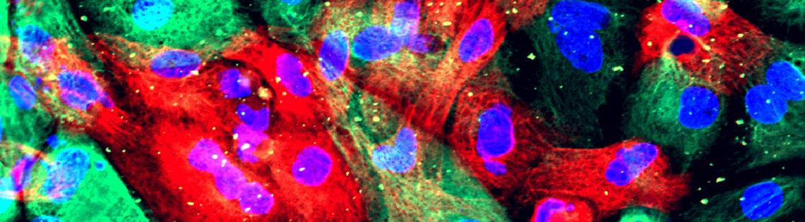 Large splotches of green and red with clusters of blue circles inside, against a black background