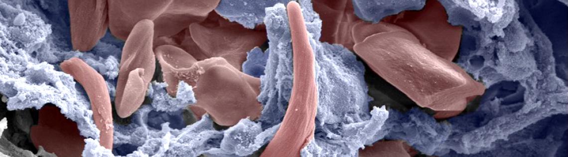 Scientific image of pinkish red icicle-shaped structures floating among bluish gray cloud-like substances