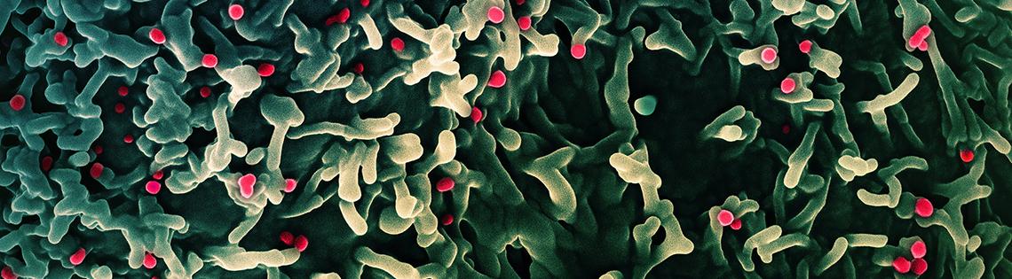 scientific image featuring mass of green and white rice-shaped objects with small red bulbs sprinkled throughout