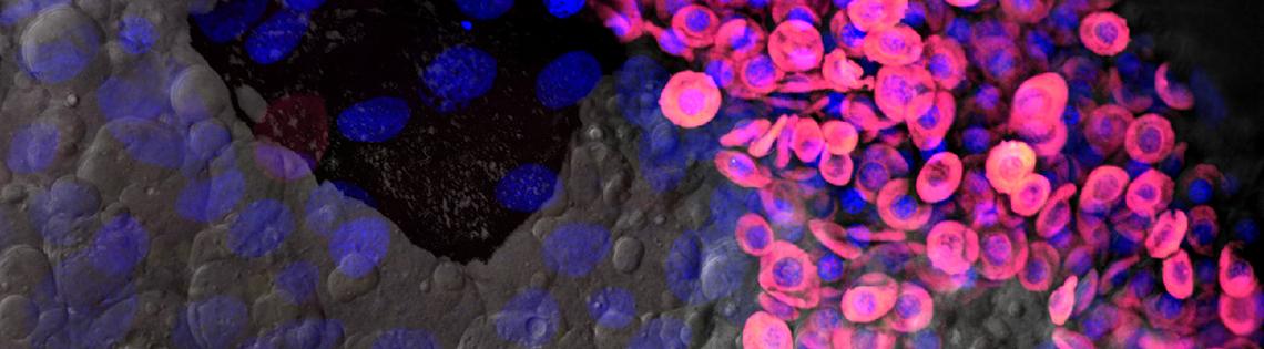 Scientific image of magenta, yellow, and blue disks floating in a dark background