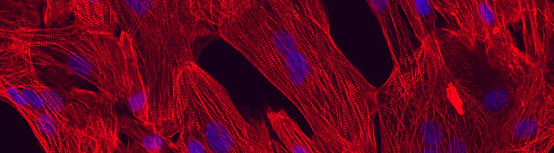 Large chunks of red with blue dots