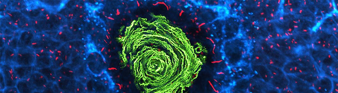 scientific image of green circular swirl surrounded by small red dashes on a blue webbed background  