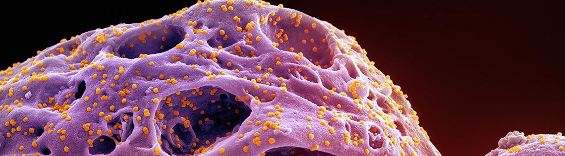 Novel Coronavirus SARS-CoV-2 (Omicron) 