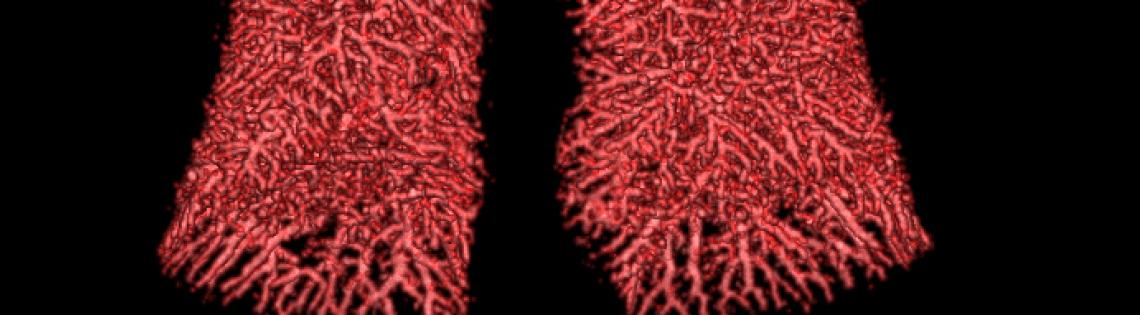 Computed tomography 3D rendering of the lungs