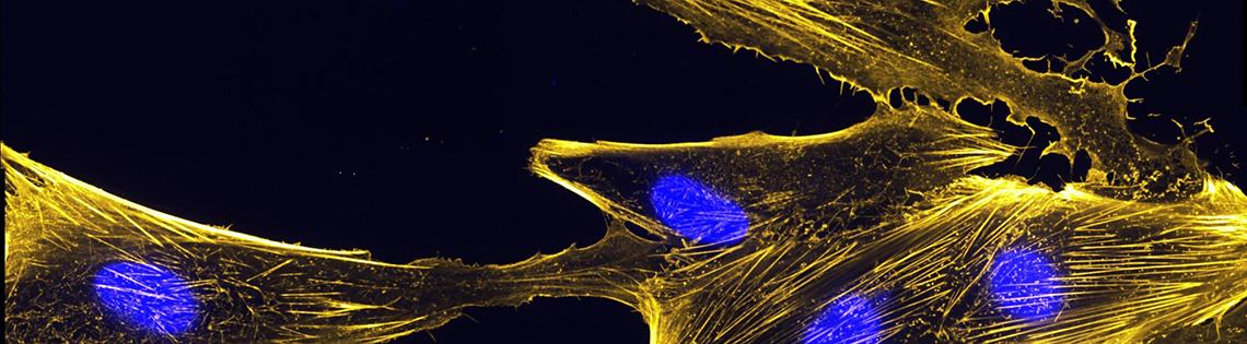 Immunofluorescence image of actin bundles in muscle precursor cells called myoblasts