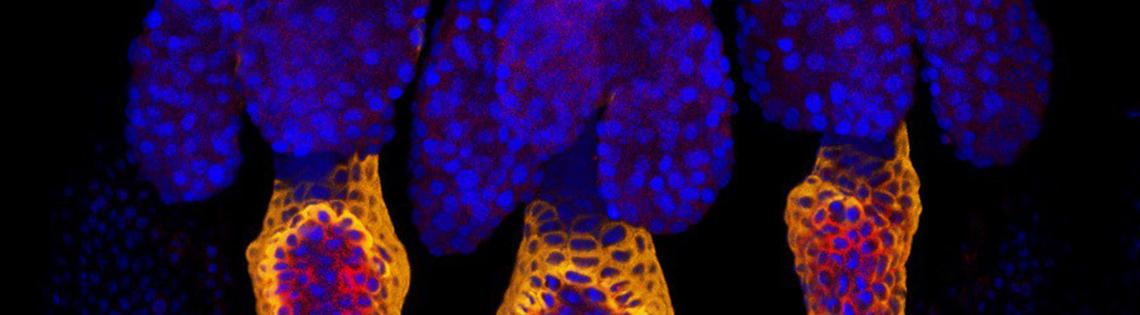 Three yellow taiils with orange and red wisps, each topped with huge clusters of tiny blue dots, against black background